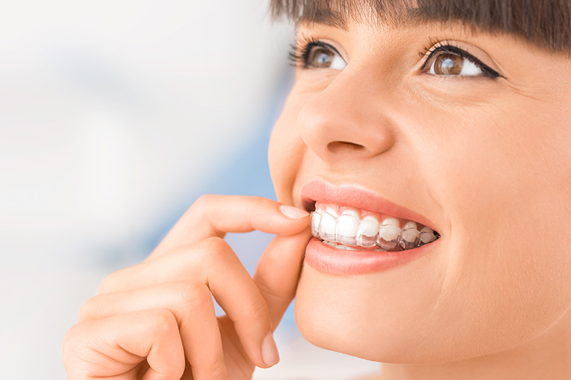 Invisalign in Feasterville